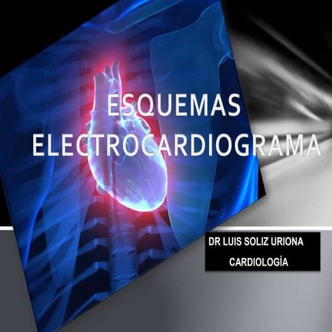 Esquemas comparativos Electrocardiograma