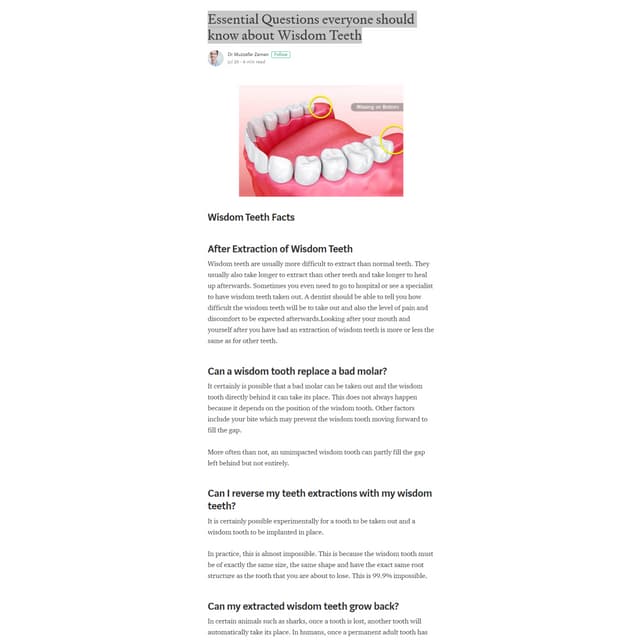 Essential questions everyone should know about wisdom teeth - Dr Muzzafar Zaman