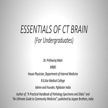 Essentials of CT brain (For Undergraduates)