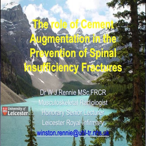 Pedicle screw fixation in osteoporotic fractures | PPTX