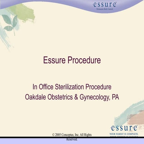 Essure