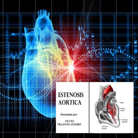 Estenosis Aortica