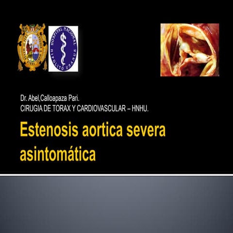 Estenosis aortica severa asintomatica