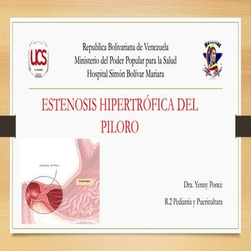 estenosis pilorica | PPTX