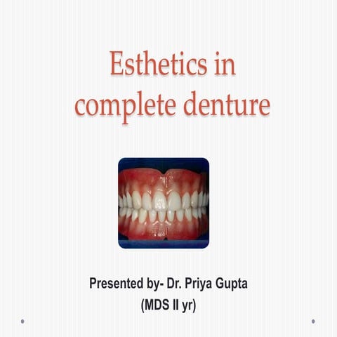 Esthetics in complete denture