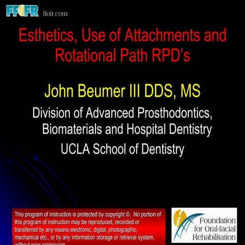 Esthetics, rotational path, attachments