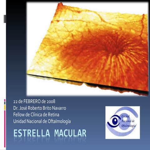 Estrella Macular