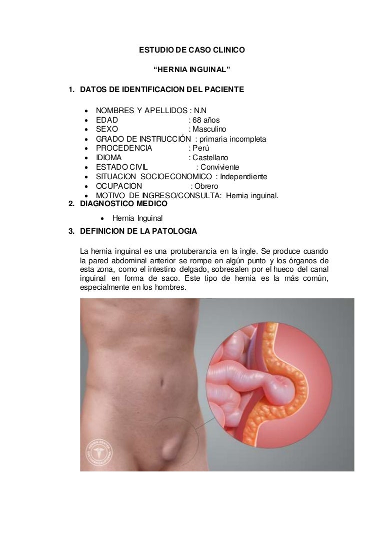 Hernia Inguinal En Ingles Hernia Inguinal En Ingles