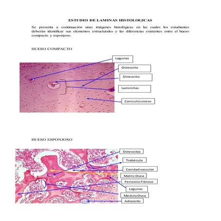 ESTUDIO DE LAMINAS HISTOLOGICAS HUESO (PABLO JHYLMAR ACEBEDO QUISPE).docx