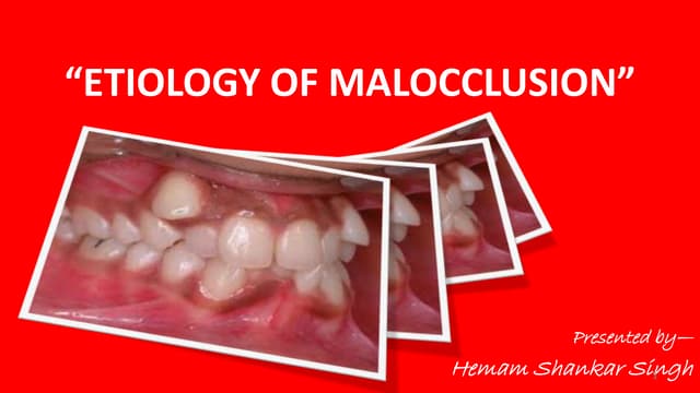 Etiology of malocclusion