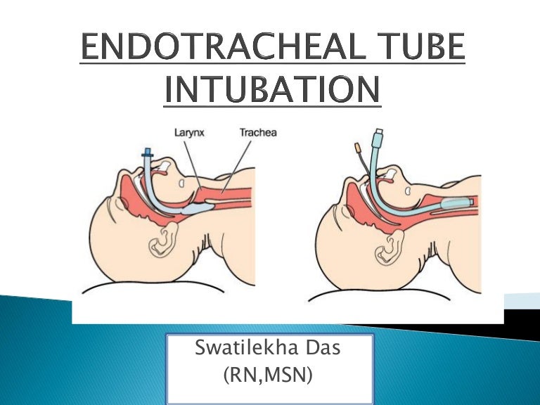 ENDOTRACHEAL TUBE INTUBATION II Parts II Details II Clinical Discussi…
