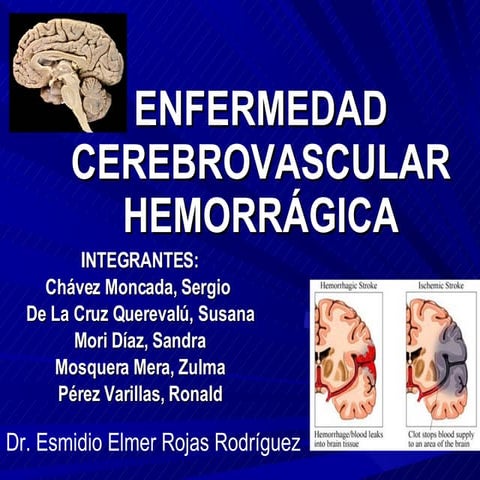 Evc Hemorragico