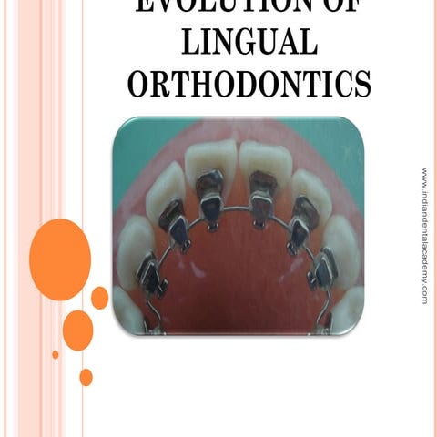 Evolution of lingual orthodontics