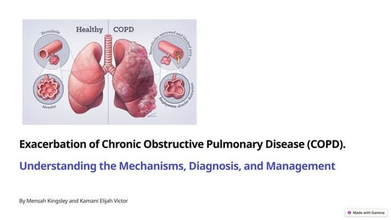 Management of copd exacerbations | PDF | Lung and Respiratory Health ...