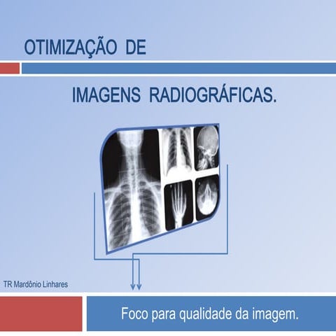 Exames Radiológicos-Otimização de Imagens - TR Mardônio Linhares