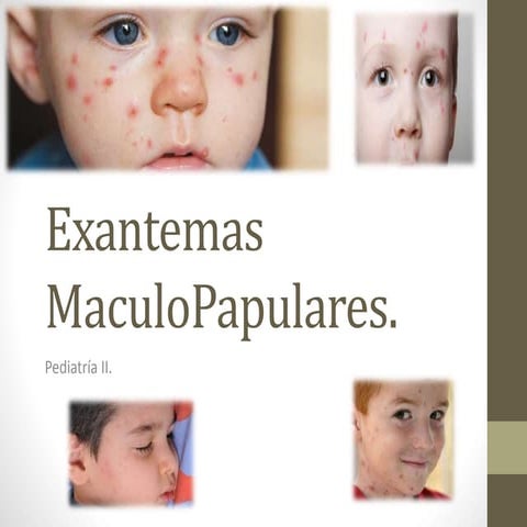 Exantemas maculo papulares | PPTX