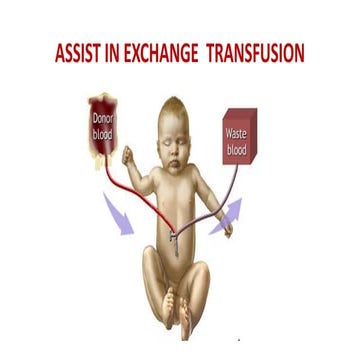 Exchange  transfusion