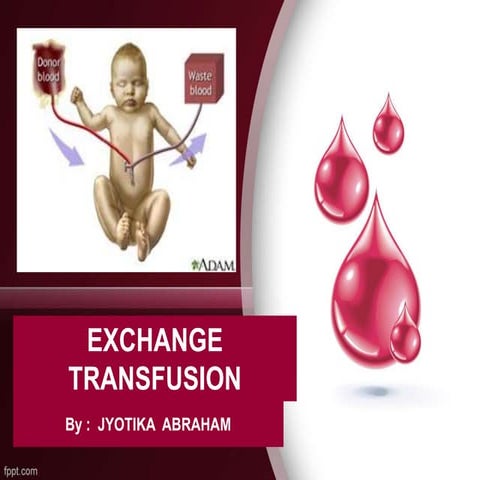 Exchange Transfusion PPT
