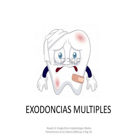 Exodoncias Multiples