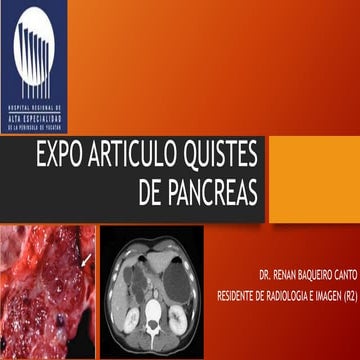 Expo articulo quistes de pancreas