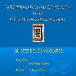 QUISTE DE LOS MAXILARES