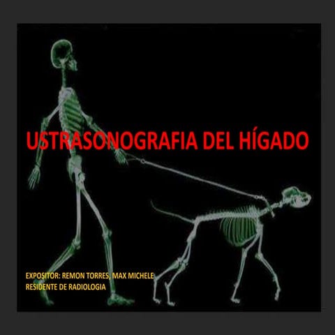 ECOGRAFIA HIGADO
