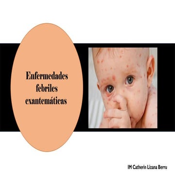 EXANTEMAS.pptx....................................