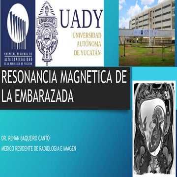 Resonancia magnetica de la embarzada
