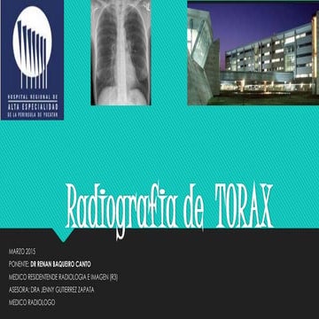 Radiografia de Torax