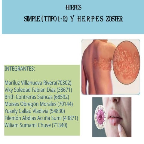 Comprehensive Overview of Herpes Simplex and Herpes Zoster Infections ...