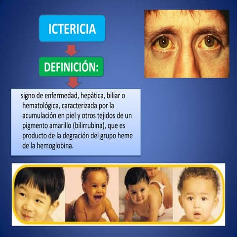 sindrome icterico | PPTX