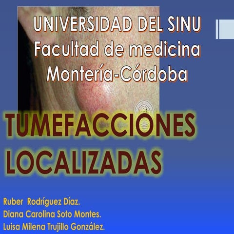 masas y tumefacciones localizadas