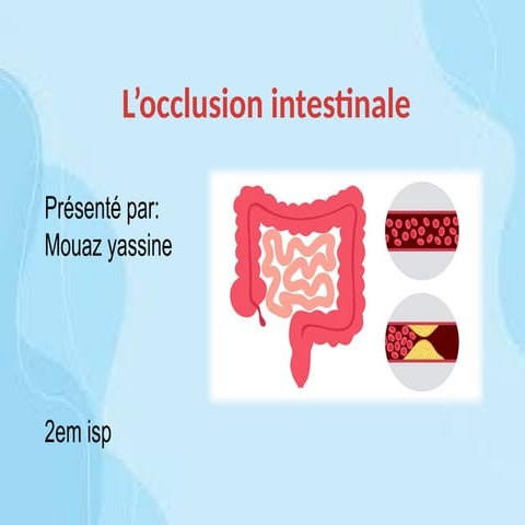 Occlusion Intestinale 2em isp paramédical.pptx