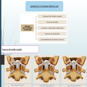 FRACTURA PILON DE TIBIA Universidad de Guayaquil.pptx