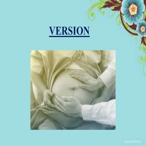 EXTERNAL CEPHALIC VERSION OBG NOTES .pptx