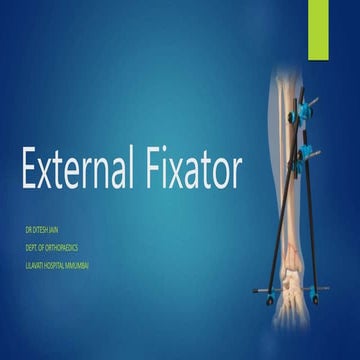 External fixator