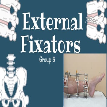 Principles of external fixation | PPTX