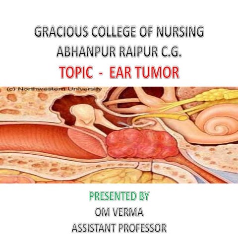 Inner ear tumor | PPTX