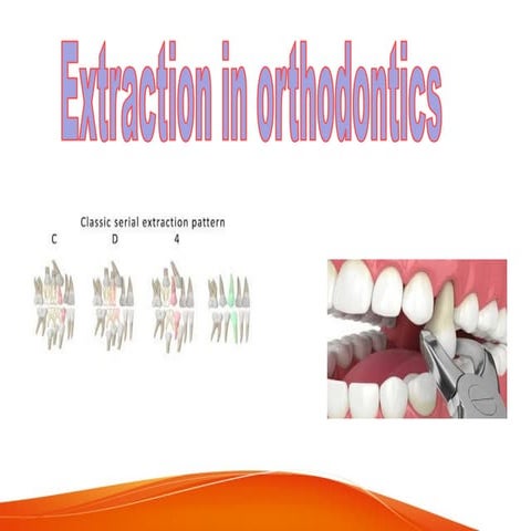 Extraction Of The First Permanent Molar | ODP