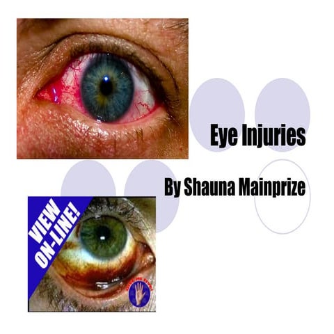 Eye Injuries