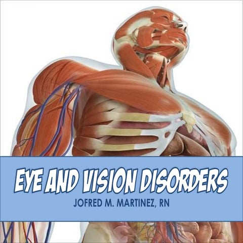 MS Eye and Vision Disorders