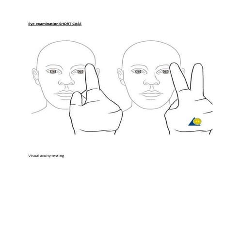 Eye examination short case