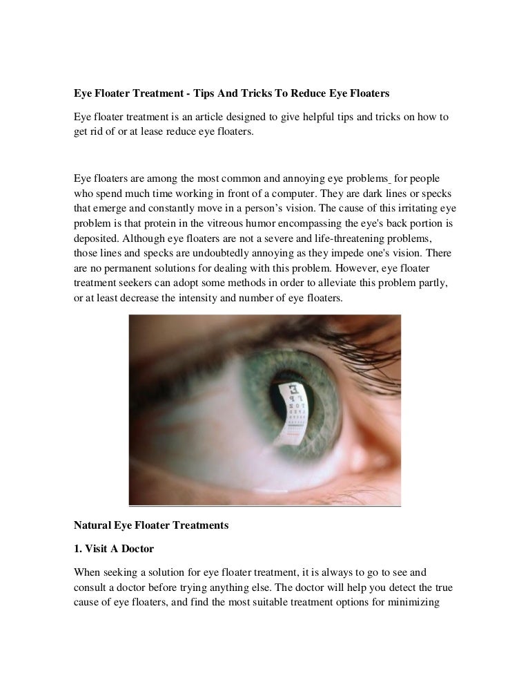 Eye Floater Treatment Tips And Tricks To Reduce Eye Floaters