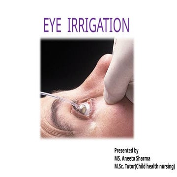 Eye irrigation | PPTX