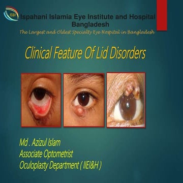 Disorders of eyelids