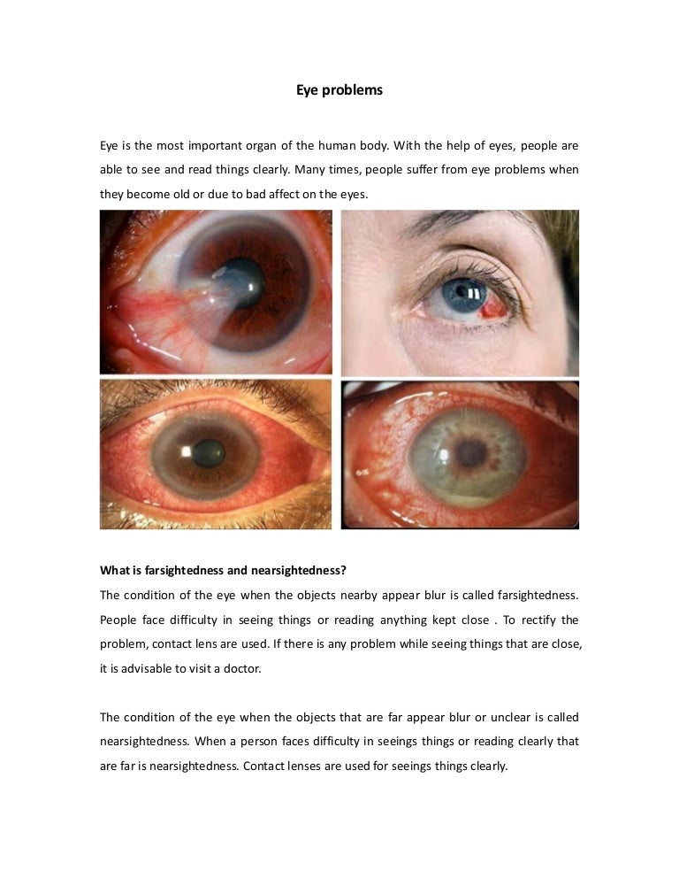 Eye problems in India