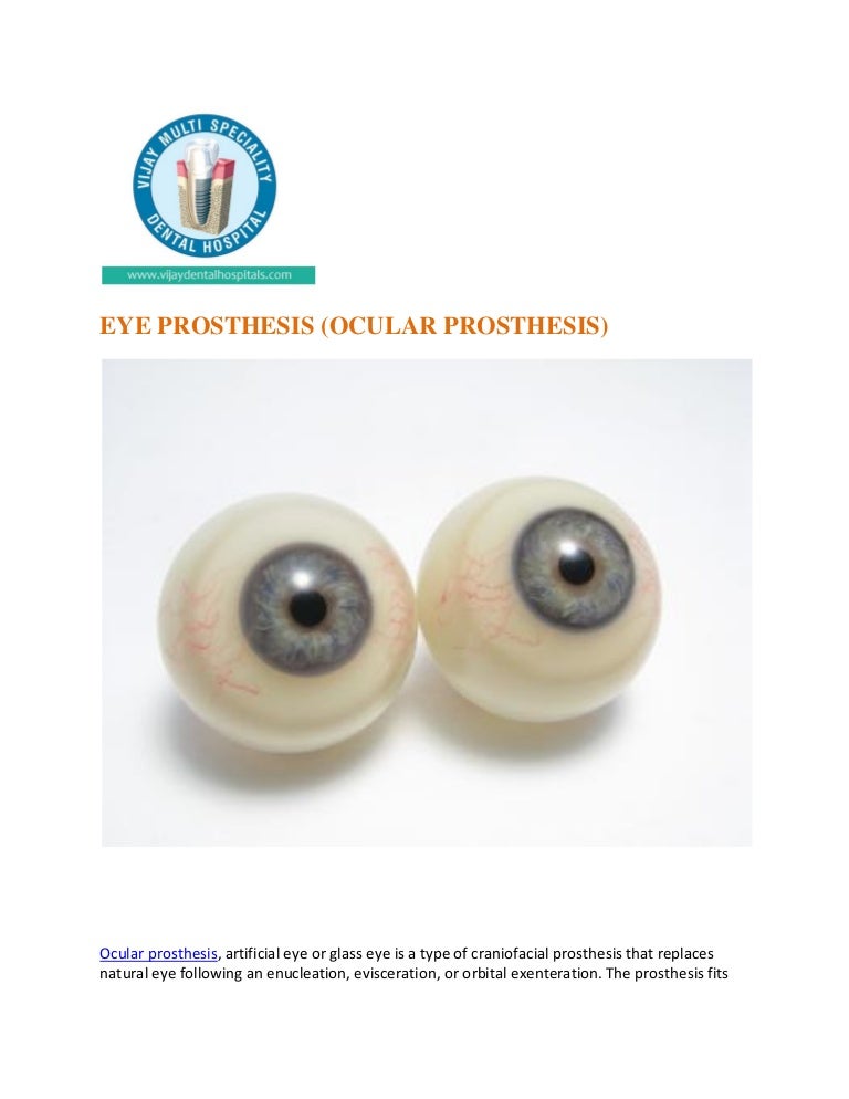 Eye prosthesis