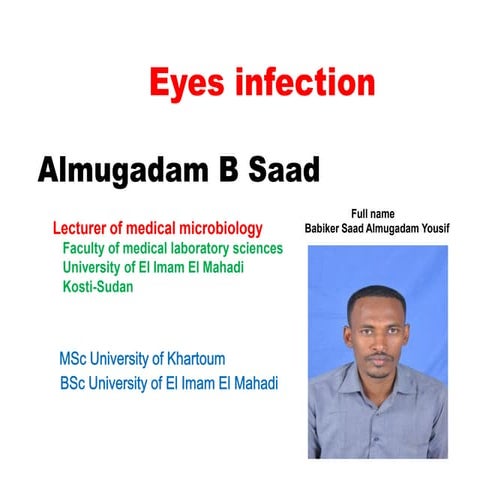 Eyes infection 