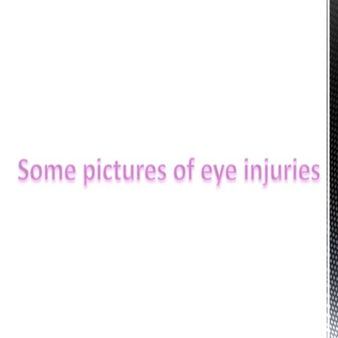 power point of extra material about eye trauma