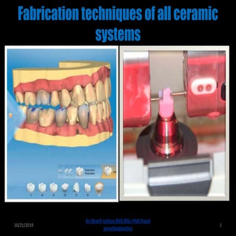 Dental Ceramics and Porcelain fused to metal | PPTX